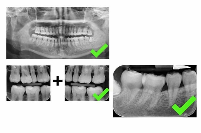 xrays-photos